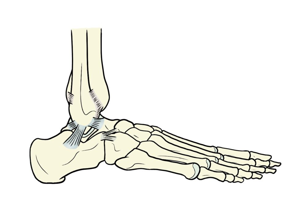 足関節捻挫・内反捻挫