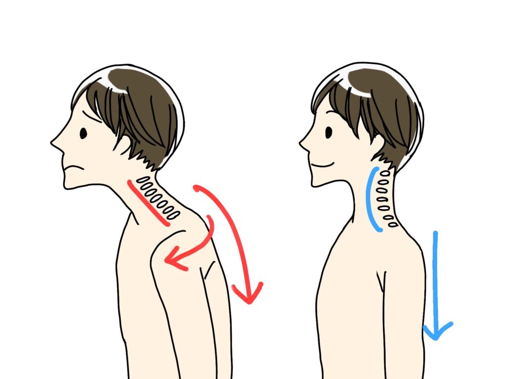 肩凝り・頭痛・めまい・猫背・ストレートネック
